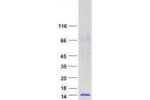 WAP Four-Disulfide Core Domain 6 (WFDC6) protein (Myc-DYKDDDDK Tag)