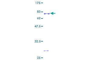 CLASP2 Protein (AA 1-431) (GST tag)