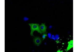 Image no. 5 for anti-Bruton Agammaglobulinemia tyrosine Kinase (BTK) antibody (ABIN1496973) (BTK antibody)