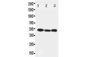 Anti-Beclin 1 antibody, Western blotting Lane 1: HELA Cell Lysate Lane 2: SW620 Cell Lysate Lane 3: PANC Cell Lysate