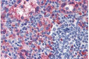 Human Spleen: Formalin-Fixed, Paraffin-Embedded (FFPE) (TXNIP antibody  (C-Term))