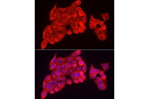 Immunofluorescence analysis of HeLa cells using INPP5K Rabbit pAb (ABIN6132112, ABIN6142473, ABIN6142474 and ABIN6223771) at dilution of 1:150 (40x lens). (INPP5K antibody  (AA 149-448))