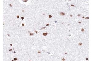 ABIN6268797 at 1/100 staining human brain tissue sections by IHC-P. (EZH1 antibody  (Internal Region))