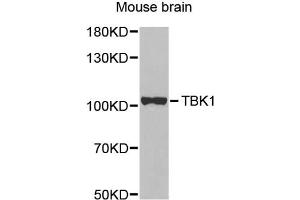 Western blot analysis of extracts of mouse brain, using TBK1 antibody. (TBK1 antibody)