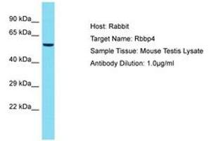 Image no. 1 for anti-Retinoblastoma Binding Protein 4 (RBBP4) (C-Term) antibody (ABIN6750365)