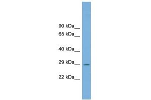 WB Suggested Anti-C1orf43 Antibody Titration: 0. (C1orf43 antibody  (Middle Region))