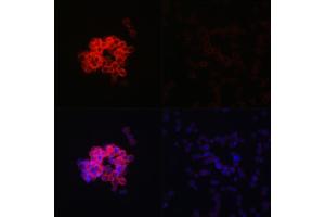 Immunofluorescence (IF) image for anti-Interferon Induced with Helicase C Domain 1 (IFIH1) (AA 1-205) antibody (ABIN6142174)