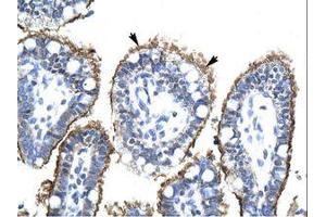 Image no. 1 for anti-Zinc Finger, HIT-Type Containing 6 (ZNHIT6) (AA 300-349) antibody (ABIN202608) (ZNHIT6 antibody  (AA 300-349))