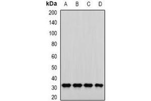 Western blot analysis of PNP expression in SKOV3 (A), MCF7 (B), mouse liver (C), mouse kidney (D) whole cell lysates. (PNP antibody)