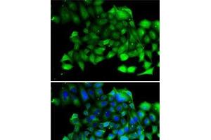 Immunofluorescence analysis of A-549 cells using CLIC4 Polyclonal Antibody (CLIC4 antibody)