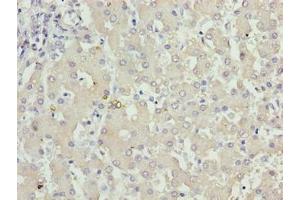 Immunohistochemistry of paraffin-embedded human liver tissue using ABIN7157483 at dilution of 1:100 (KHDC1 antibody  (AA 74-237))