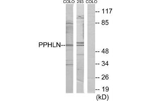 Western blot analysis of extracts from COLO cells and 293 cells, using PPHLN antibody. (PPHLN1 antibody  (Internal Region))