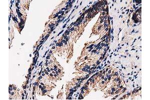 Image no. 6 for anti-Striatin Interacting Protein 1 (STRIP1) antibody (ABIN1498204)