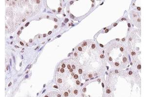 ABIN6267388 at 1/100 staining human Kidney tissue sections by IHC-P. (ATF2 antibody  (pSer94, pSer112))