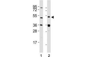 Western blot testing of LAG3 antibody at 1:2000 dilution tested on lysates from Lane 1: 293T; 2: human spleen; Predicted molecular weight ~54 kDa. (LAG3 antibody  (AA 103-132))