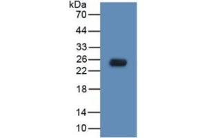 WB of Protein Standard: different control antibodies  against Highly purified E. (TLR5 ELISA Kit)