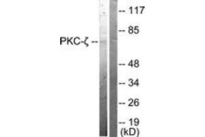 Western blot analysis of extracts from NIH-3T3 cells, treated with PMA 125ng/ml 30', using PKC zeta (Ab-410) Antibody. (PKC zeta antibody  (AA 376-425))
