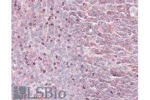 ABIN570940 (3. (Septin 6 antibody  (Internal Region))