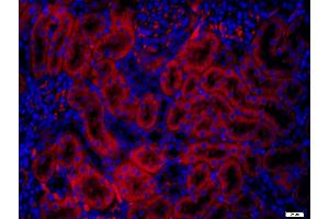 Paraformaldehyde-fixed, paraffin embedded rat kidney; Antigen retrieval by boiling in sodium citrate buffer (pH6) for 15min; Block endogenous peroxidase by 3% hydrogen peroxide for 20 minutes; Blocking buffer (normal goat serum) at 37°C for 30min; Antibody incubation with CD4 Polyclonal Antibody, AF555 conjugated (bs-0647R-A555) at 1:200 at 4°C for 90 minutes and DAPI staining of the nuclei. (CD4 antibody  (AA 385-457) (Alexa Fluor 555))