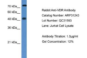 WB Suggested Anti-VDR Antibody   Titration: 1. (Vitamin D Receptor antibody  (N-Term))