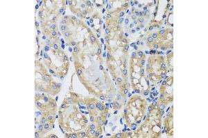 Immunohistochemistry of paraffin-embedded mouse kidney using MRPS22 antibody. (MRPS22 antibody)