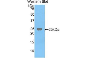 Western blot analysis of the recombinant protein. (FDFT1 antibody  (AA 217-416))
