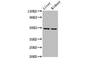 Western Blot Positive WB detected in: Rat liver tissue, Rat kidney tissue All lanes: DLST antibody at 5. (DLST antibody  (AA 76-225))