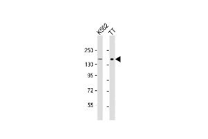 All lanes : Anti-c-KIT Antibody (C-term) at 1:1000 dilution Lane 1: K562 whole cell lysate Lane 2: TT whole cell lysate Lysates/proteins at 20 μg per lane. (KIT antibody  (AA 912-941))