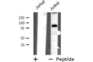 Western blot analysis of extracts from Jurkat cells, using CHFR antibody. (CHFR antibody)