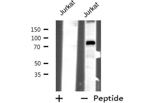 CHFR antibody