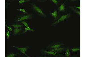 Immunofluorescence of purified MaxPab antibody to DYRK1B on HeLa cell. (DYRK1B antibody  (AA 1-629))