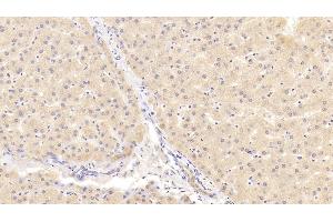Detection of NOTCH2 in Human Liver Tissue using Polyclonal Antibody to Notch Homolog 2 (NOTCH2) (NOTCH2 antibody  (AA 2251-2466))