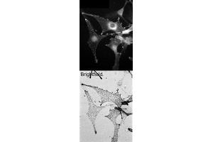 Wild-type C57bl6 derived melanocytes were stained with (ABIN184753) (0. (Melanophilin antibody  (C-Term))