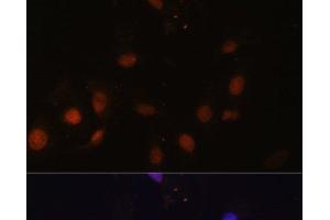 Immunofluorescence analysis of U-2 OS cells using SNW1 Polyclonal Antibody at dilution of 1:100. (SNW1 antibody)