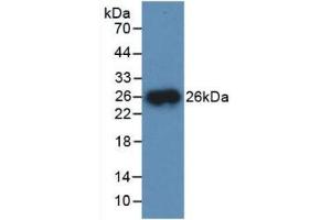 Detection of Recombinant CTSB, Mouse using Polyclonal Antibody to Cathepsin B (CTSB) (Cathepsin B antibody  (AA 129-333))