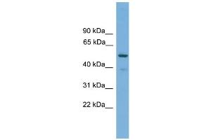 WB Suggested Anti-TRIM38 Antibody Titration: 0. (TRIM38 antibody  (Middle Region))