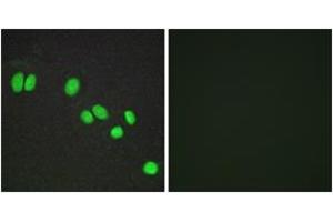 Immunofluorescence analysis of A549 cells, using NCOR2 Antibody. (NCOR2 antibody  (AA 511-560))