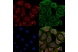 anti-EPH Receptor B1/2 (EPHB1/2) antibody