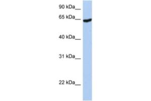 Western Blotting (WB) image for anti-Insulin-Like Growth Factor 2 mRNA Binding Protein 1 (IGF2BP1) antibody (ABIN2462219) (IGF2BP1 antibody)
