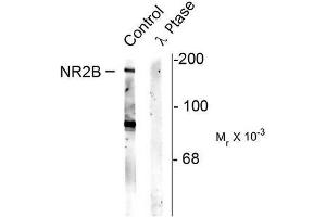 Image no. 1 for anti-Glutamate Receptor, Ionotropic, N-Methyl D-Aspartate 2B (GRIN2B) (pSer1480) antibody (ABIN372688) (GRIN2B antibody  (pSer1480))