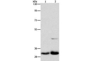 Western Blot analysis of Lovo and PC3 cell using MPG Polyclonal Antibody at dilution of 1:950 (MPG antibody)