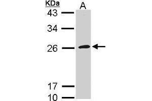 WB Image Sample (30 ug of whole cell lysate) A: Raji 12% SDS PAGE antibody diluted at 1:1000 (GP1BB antibody  (Internal Region))