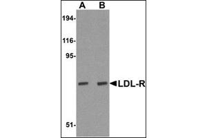 Western blot analysis of LDL-R in human liver tissue lysate with this product at (A) 1 and (B) 2 μg/ml.
