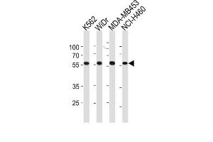 Western Blotting (WB) image for anti-Nuclear Pore Complex Interacting Protein-Like 2 (NPIPL2) antibody (ABIN3004718) (NPIPL2 antibody)