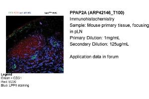 Sample Type: Mouse primary tissue, focusing in pLNPrimary Dilution: 1mg/mLSecondary Dilution: 125ug/mL (PPAP2A antibody  (Middle Region))