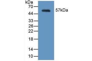 Detection of Recombinant MYH2, Mouse using Polyclonal Antibody to Myosin Heavy Chain 2 (MYH2) (MYH2 antibody  (AA 1238-1472))