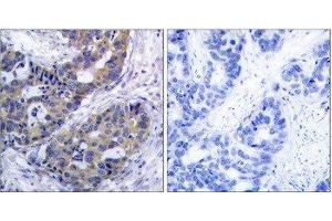 Immunohistochemistry (IHC) image for anti-Insulin Receptor Substrate 1 (IRS1) (Ser312) antibody (ABIN1848112) (IRS1 antibody  (Ser312))