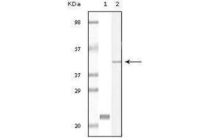 Western blot analysis using CIB1 mouse mAb against truncated CIB1 recombinant protein (1) and A431 cell lysate (2). (CIB1 antibody)