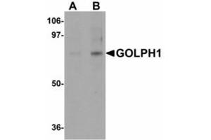 Image no. 1 for anti-Acyl-CoA Binding Domain Containing 3 (Acbd3) (N-Term) antibody (ABIN478179) (ACBD3 antibody  (N-Term))