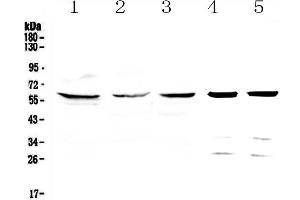 Western blot analysis of TCP1 eta using anti-TCP1 eta antibody .